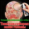 Aofolai Russian Scalp Ringworm Spray