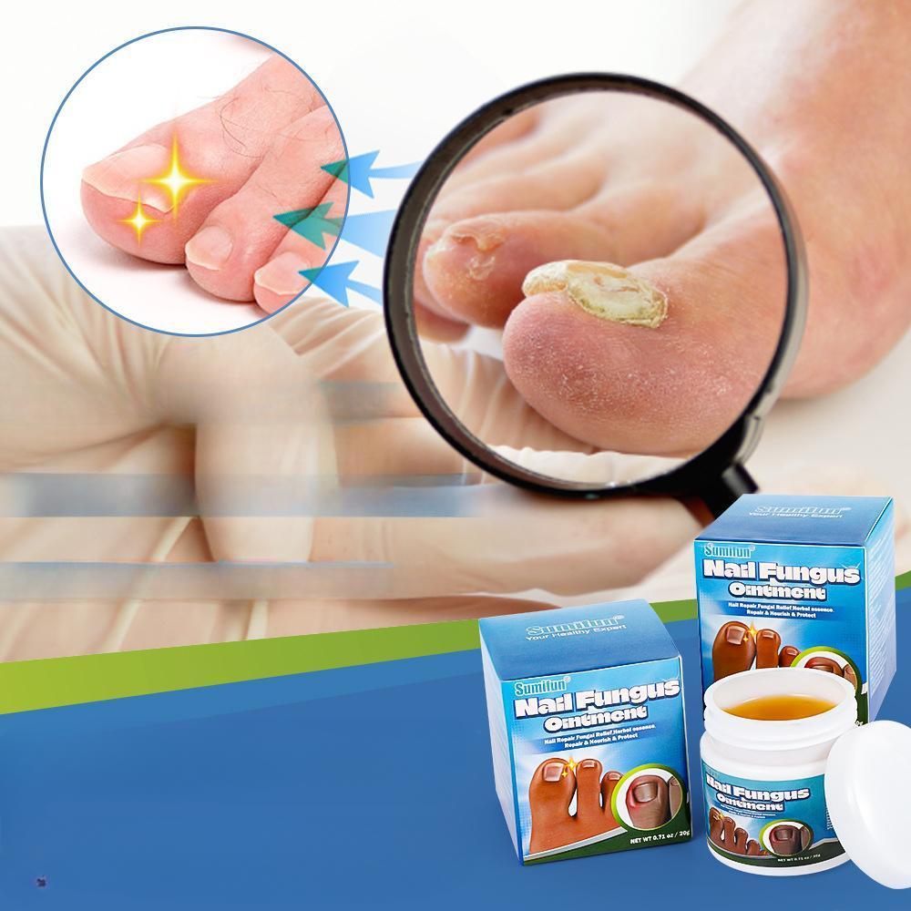 Крем Jiagoukang Cream для ухода за густыми ногтями