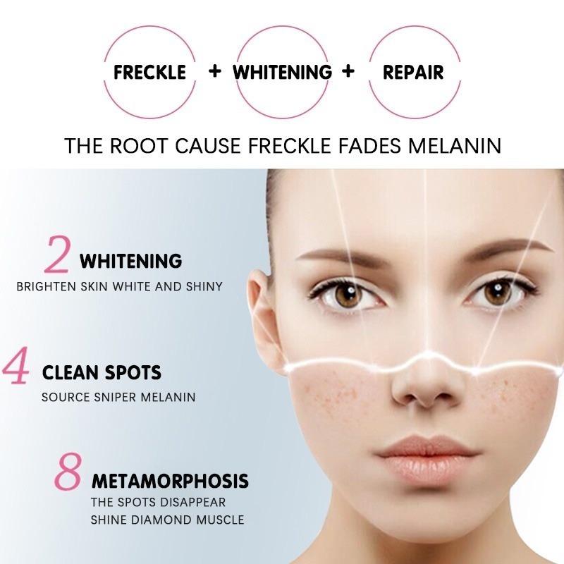 Отбеливающий крем, исчезающие пятна, черные точки, меланин, увлажняющий, осветляющий, мягкий, гладкий, укрепляющий, уход за кожей
