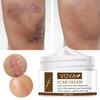 Yousheng 30ml Scar Cream Quick Absorption Smoothing Skin Natural Extract Acne Removal Smoothing Whitening Moisturizing Cream for Female