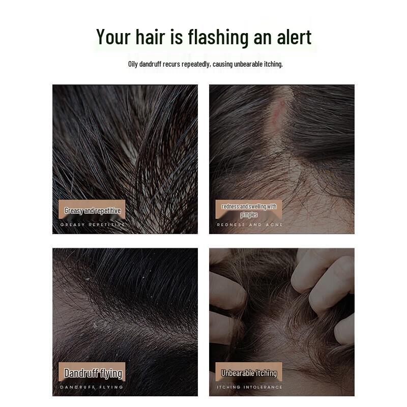 100 Years Runfa Oil Control & Hair Care Shampoo Set