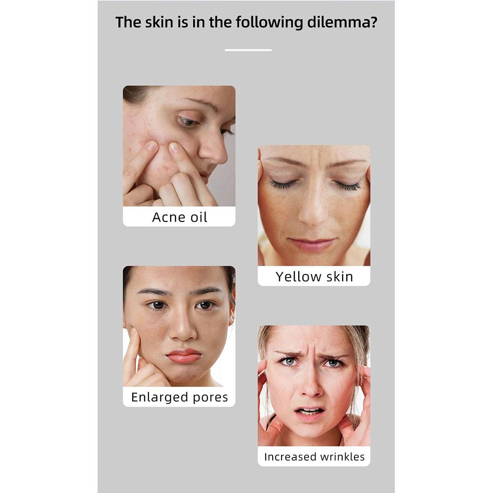 4-цветная светодиодная маска для лица с 240 шариками фотонной терапии, контроль жирности и осветление кожи, уменьшение морщин и лечение акне для омоложения лица