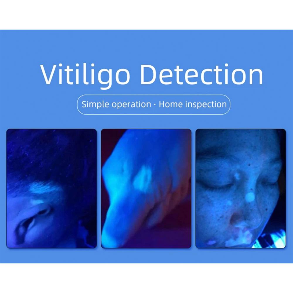 Лампа Вуда Ультрафиолетовый УФ Инструмент для Анализа Кожи Персональный Уход за Красотой Уход за Кожей Увеличительный Анализатор для Ежедневного Использования в Красоте