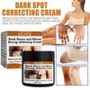Dark Knuckles Fast Whitening Cream Pigmentation Correctors Knee Knuckle Cream Hand Remover Stai M9N5