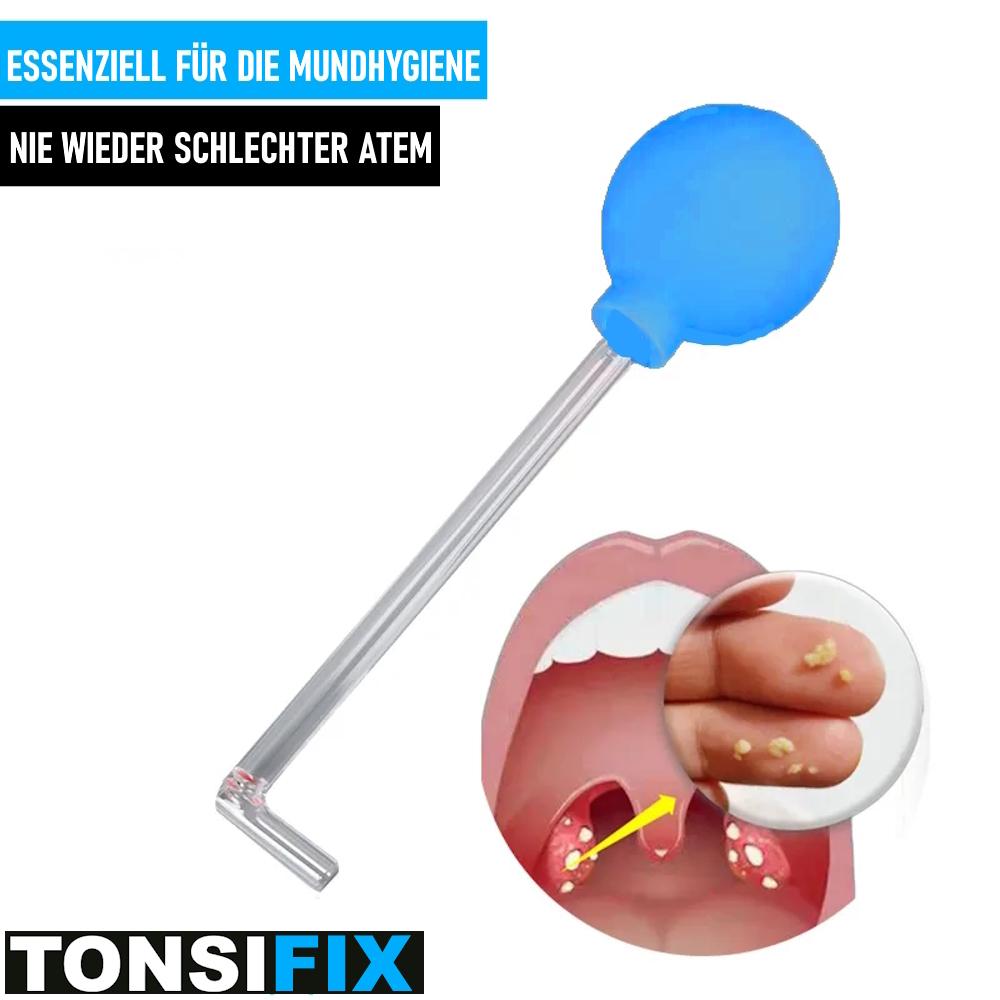 TONSIFIX средство для удаления камней из миндалин, средство для удаления камней из миндалин, присоска для удаления камней из миндалин