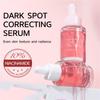 Dark Correcting / 10% Niacinamide+ 4% Tranexamic, For Post-Acne Marks, Hyperpigmentation And Even Skin Tone 30ml