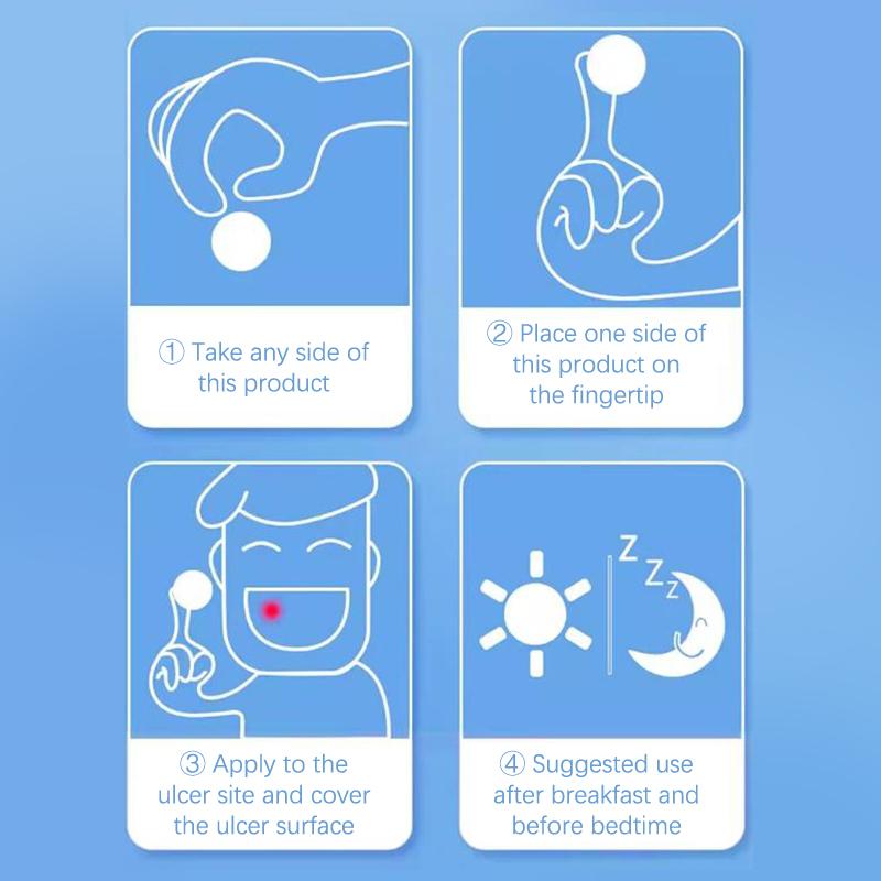 Патч для быстрого лечения язв во рту, повязка для ран полости рта при афтозном стоматите, быстрое облегчение боли, лекарство от афтозного стоматита, обезболивающее