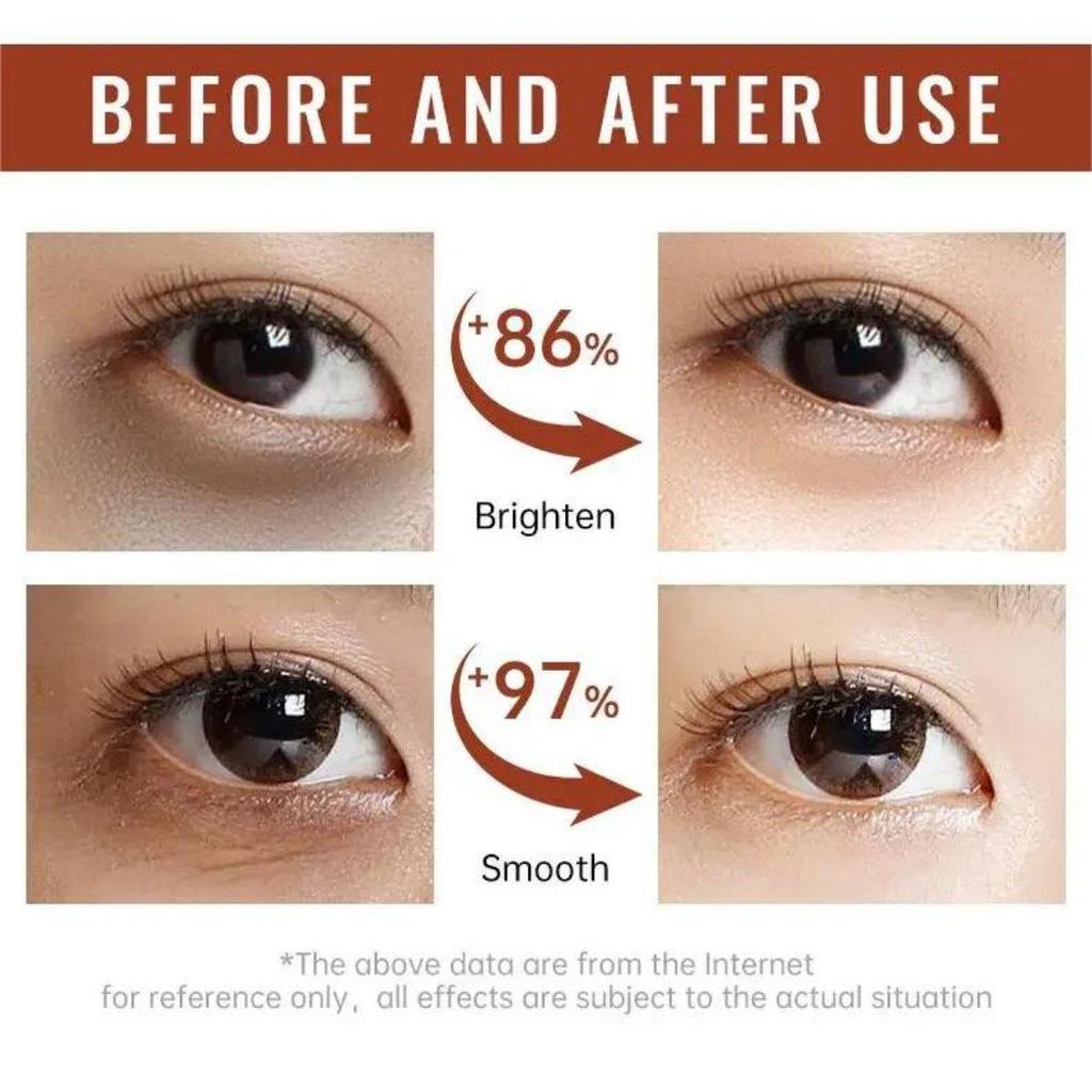 Увлажняющий крем для кожи вокруг глаз мягко, не раздражает и разглаживает морщины, уменьшает мелкие морщинки, смягчает и улучшает состояние поврежденной кожи.