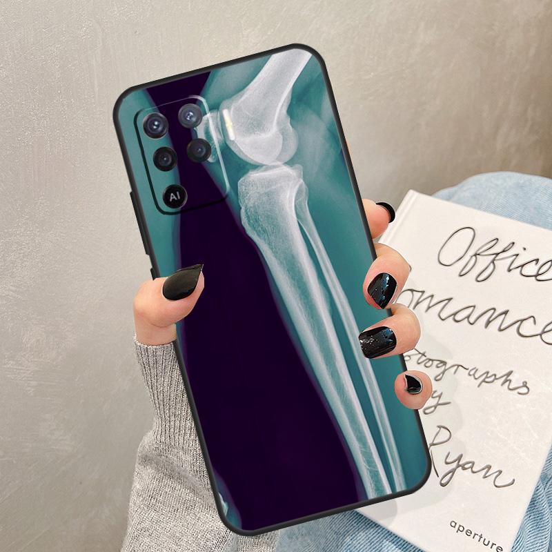 Чехол-кейс с рентгеновской анатомией человека для Oppo A40 A60 A80 A78 A38 A18 A98 A58 A96 A76 A16 A94 A74 A54 A15 A17 A57 A77 A5 Pro