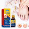 Moisturizing Hand, Foot, Nail Treating Toenails Is Suitable For Nail Care For Toes With Thick, Yellow, And Damaged Nails Liquid 30ml