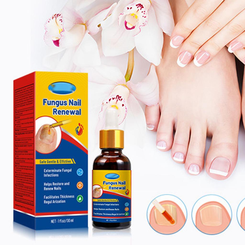 Увлажняющий крем для рук, ног, средство для лечения ногтей на ногах, подходит для ухода за ногтями на пальцах ног с толстыми, желтыми и поврежденными ногтями, жидкость 30 мл