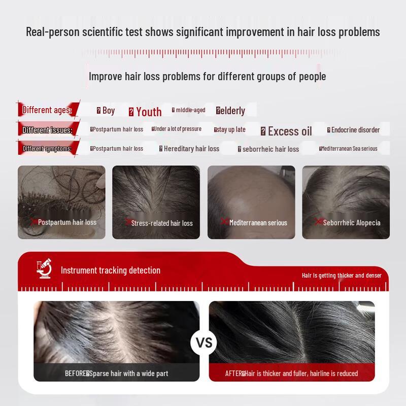 San Ge Mo Fa Jiang Ginger Anti-Hair Loss & Oil Control Shampoo