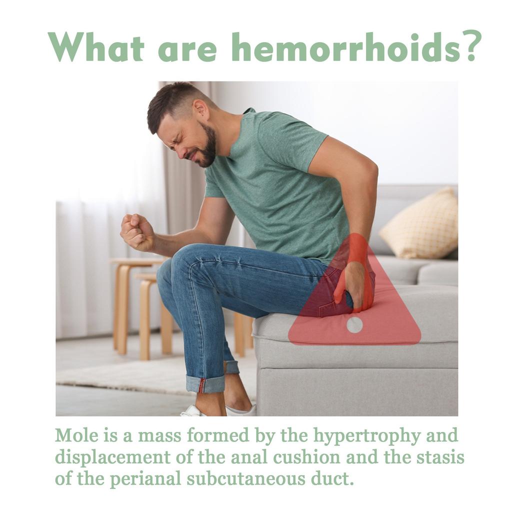 Hemorrhoid Relief Cream, Relieves Anal Swelling, Pain, Itching, Hemorrhoids, Meatballs, Soothing Cream
