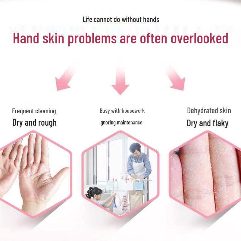 Runkelin Urea Nourishing Hand Cream