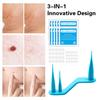 Skin Tag Remover One Hand User Friendly Home Use Safe Effective Skin Tag Removal Device Personal Care Kit