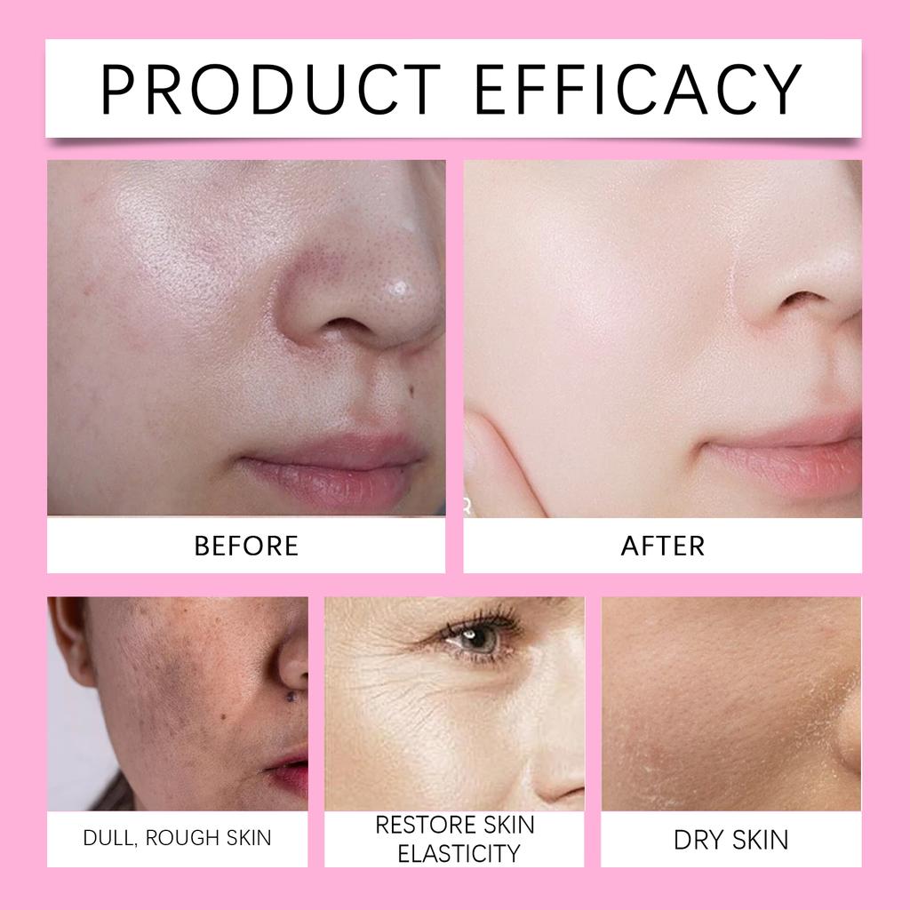 Гиалуроновый отбеливающий крем глубоко увлажняет, подтягивает и осветляет тон кожи, удерживает влагу, устраняет сухость и осветляет пятна.