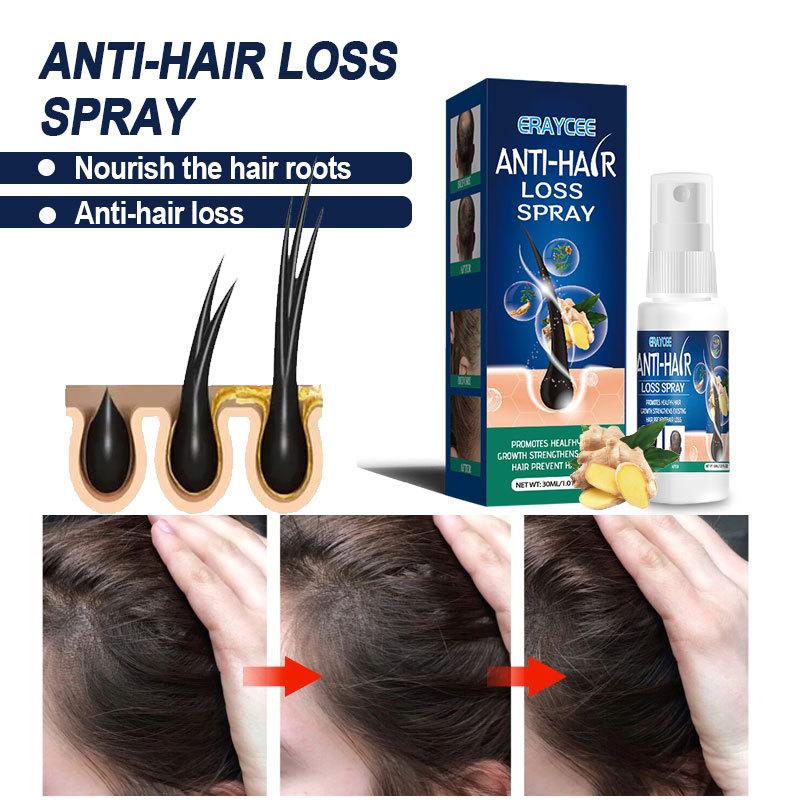 30ml Oil for Hair Growth Hair Hair Growth Vitamin E Serum Hair Vitamin Shine Serum Capsule Massage Oil