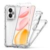 Новый популярный прозрачный акриловый чехол для мобильного телефона Honor 400 с защитой от бликов X9C, противожелтеющий, с воздушными подушками, противоударный защитный чехол