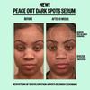 Peace Out Dark Spots Supercharged Осветляющая сыворотка 1,0 унция