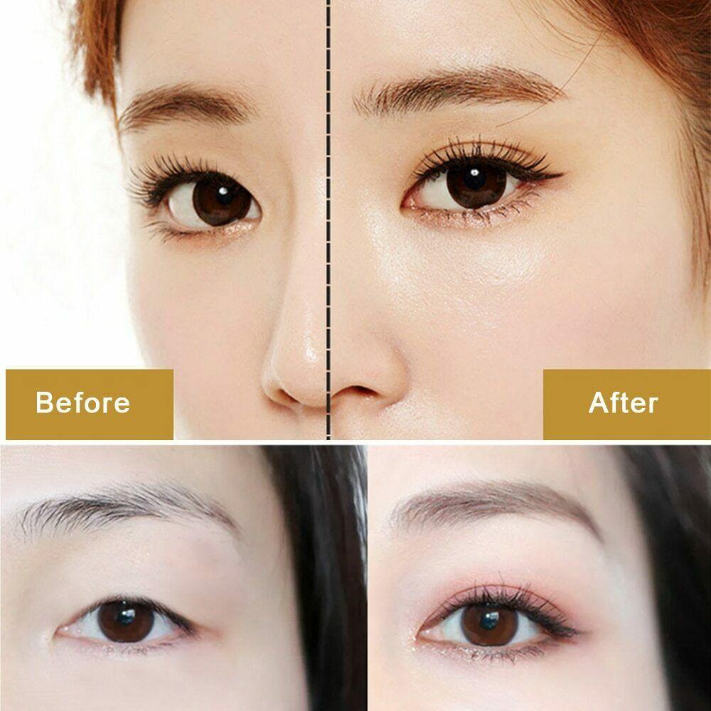 Fold Lift Double Eyelids Invisible Double Eyelid Cream Eyelid Tool Eyes Shaping Tool Eyelid Gel