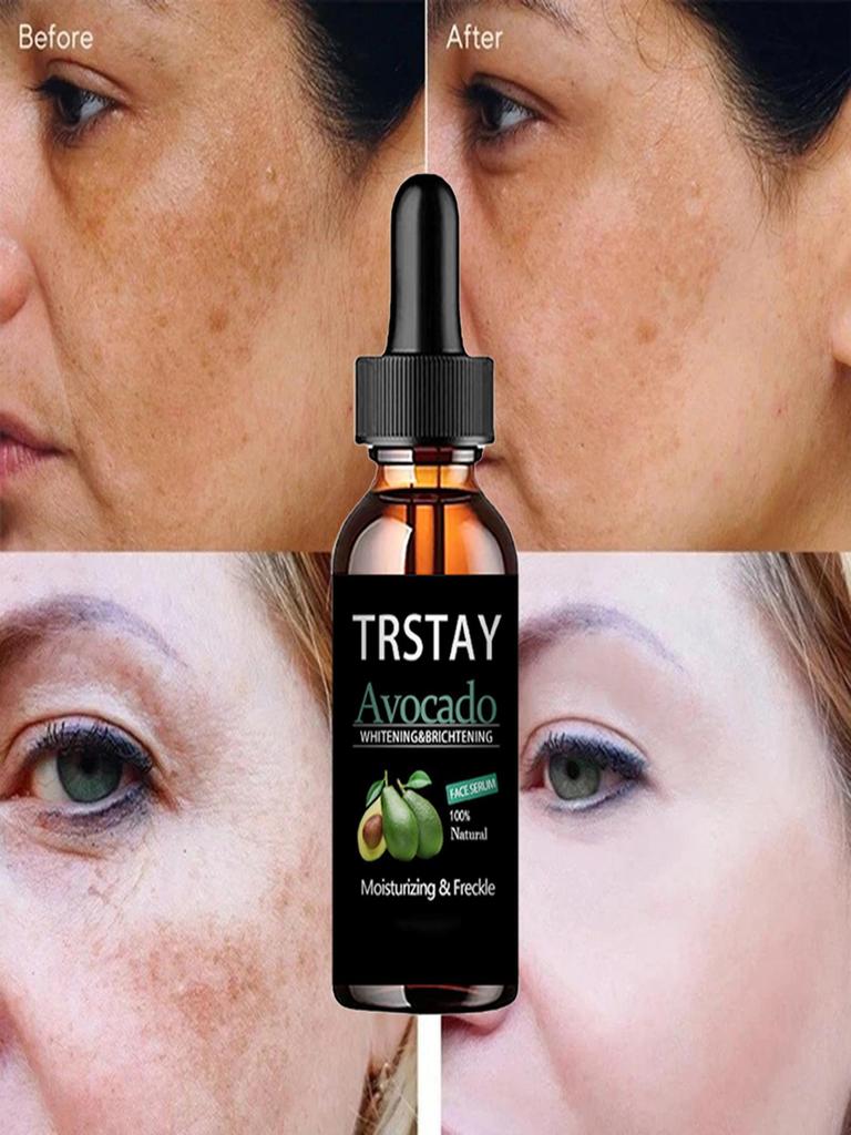 5ML/15ML/30ML/50ML/TRSTAY Dark Spot Serum Hyaluronic Acid Whitening Vitamin C, Face Serum Turmeric Collagen, Facial Skin Care Beauty