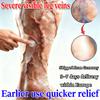 Gentle Varicose Veins Gel - Natural Herbs Eases Swelling Non-Irritating