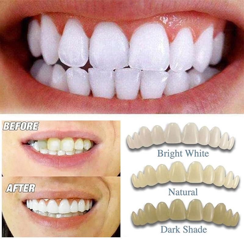 Полиморфус для лепки и установки недостающего зуба в домашних условиях