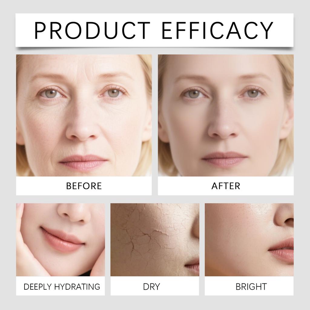 Укрепляющий антивозрастной роллер-набор с микроиглами Антивозрастной и разглаживающий морщины уход за лицом Жидкость для микроинъекций для лица, 15 мл