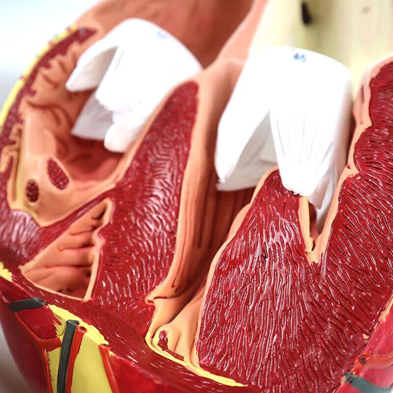 Hongyan 4-кратная съемная модель человеческого сердца