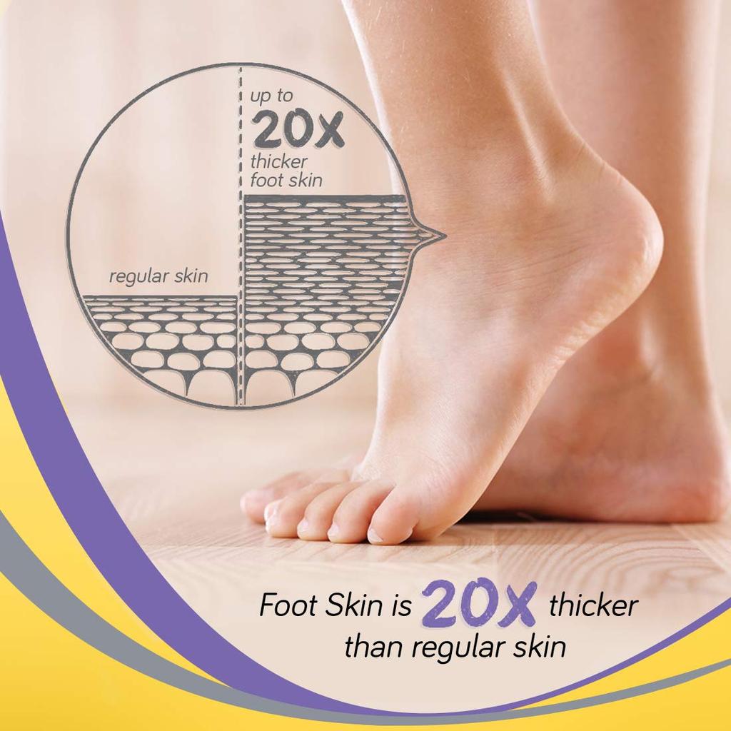 Krack Ayurvedic Heel Repair Cream, 25 Gm Pack of 2, Moisturizes and Heals Cracked Feet