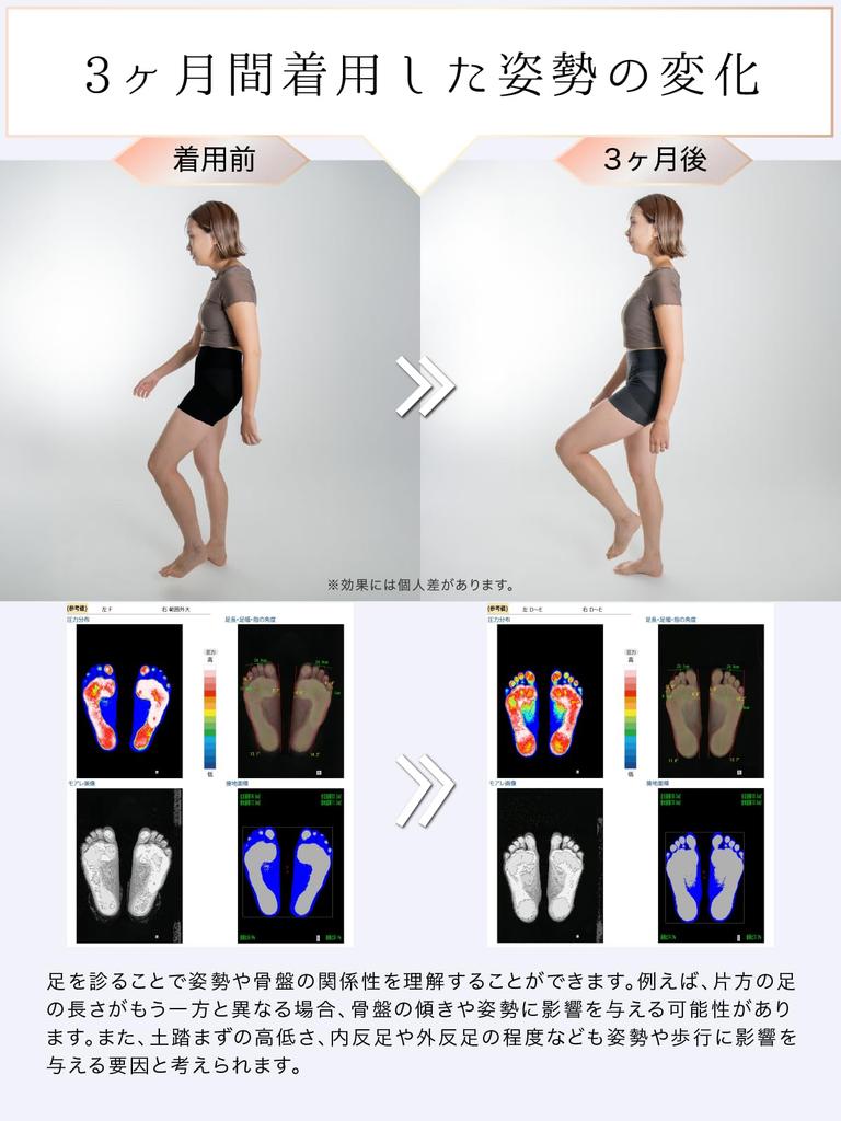 PELVISMAKE Girdle Shorts for Pelvic Correction and Lower Back Suitable for Everyday and Patent Comfortable Elastic Size Women's Pants