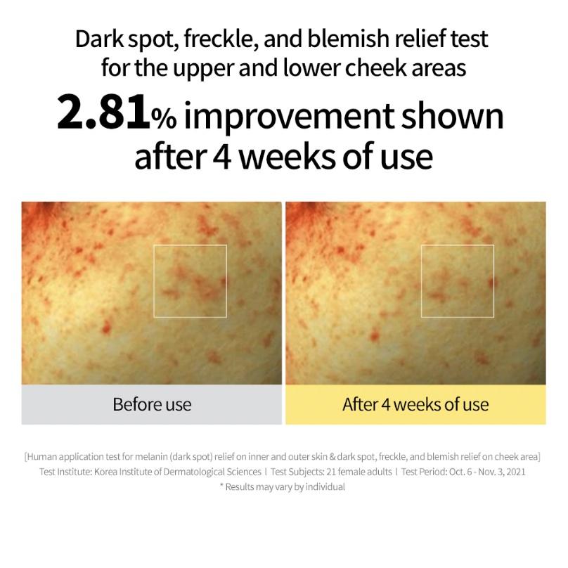 Goodal Vita C Сыворотка для ухода за темными пятнами/крем/тонизирующий крем/крем для глаз