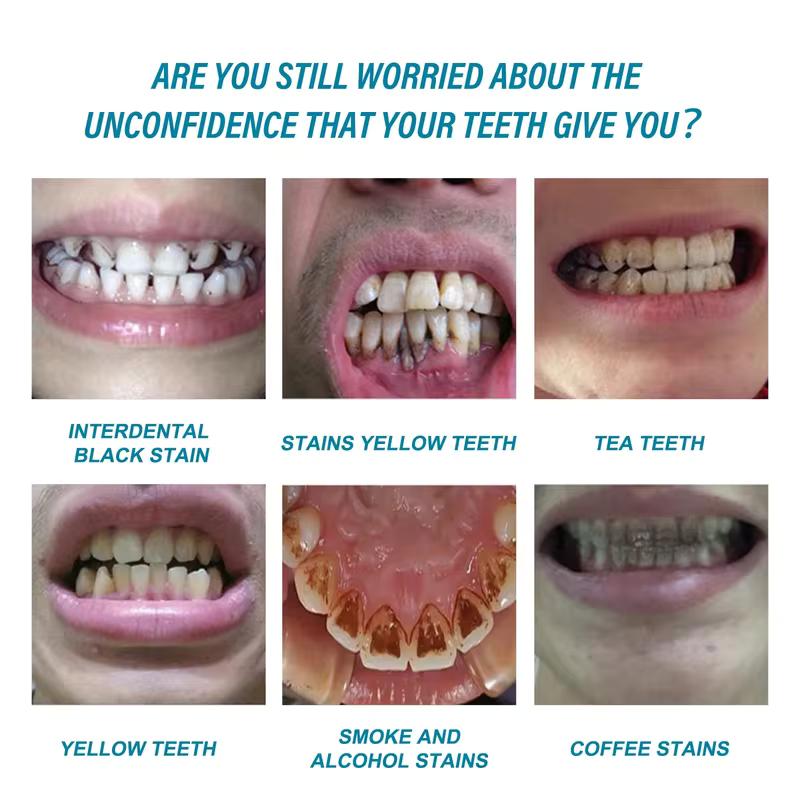 SADOER Whitening Toothpaste for Stain Removal, Fresh Breath, and Gum Care 100g