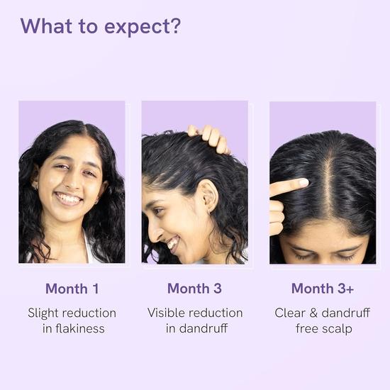 Сыворотка против перхоти для кожи головы Be bodywise 50 мл | Борется с перхотью, уменьшает шелушение и зуд кожи головы | С ихтиолом бледным, пиритионом цинка и маслом чайного дерева