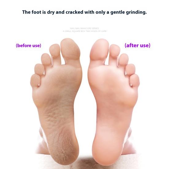 Nanoglass Foot Pillow, щетка для удаления мозолей и омертвевшей кожи, для нежного пилинга, профессиональный инструмент для педикюра