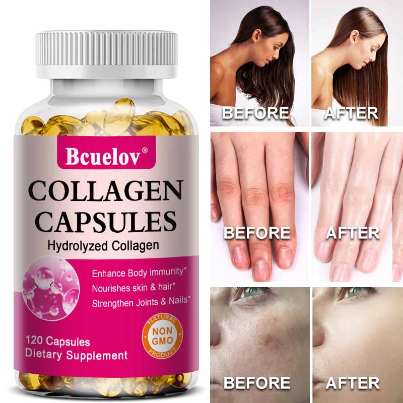 Bcuelov Hydrolyzed Bovine Collagen Dietary Supplement, 120 Softgels Per Bottle