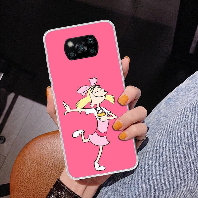 Мультяшный чехол Hey Arnold для телефона Xiaomi Poco X5 X6 X7 Pro X4 Gt F7 Ultra M8 M7 Redmi 15C 15 13C 13 12C 12 Уникальная крышка C