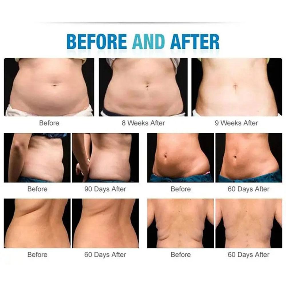 Factory T6 BIO Pen Multifunctional Beauty Machine Face Slimming Beauty Skin Care Device Blue LED EMS 360 Degree Massage RF Lift