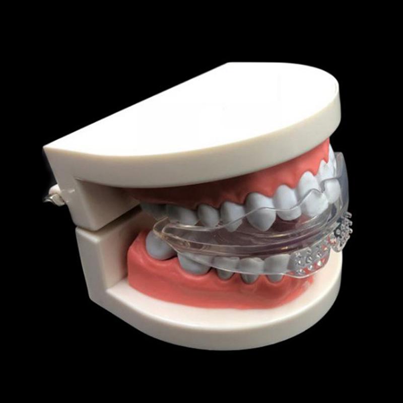 Dental Straightener Adult Fixed Silicone Braces Anti-Grinding Braces