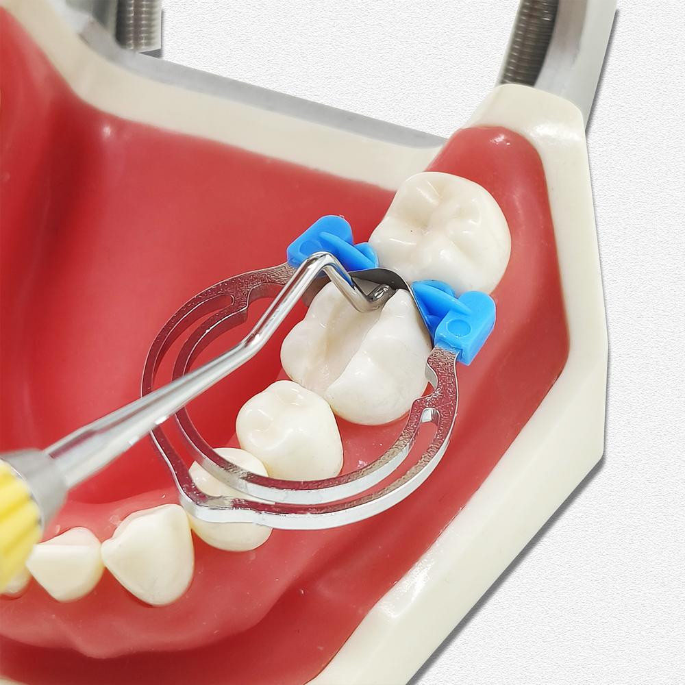 1 шт. стоматологический композитный наполнитель из смолы, контактный формирователь для плотного контакта в соседних стыках, шпатель для заполнения