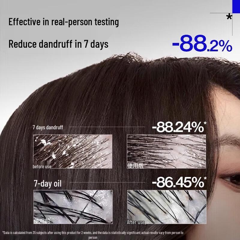 EHD Oil Control & Anti-Dandruff Shampoo and Hair Mask Set