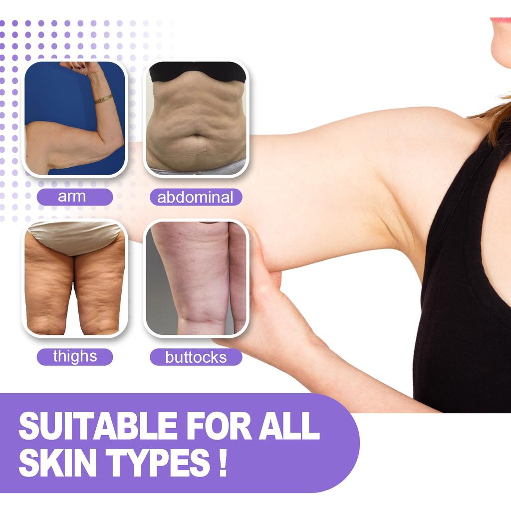 Уход за кожей с растяжками и дряблостью 2 в 1 Укрепляющий лосьон для растяжек и дряблости кожи 100 мл