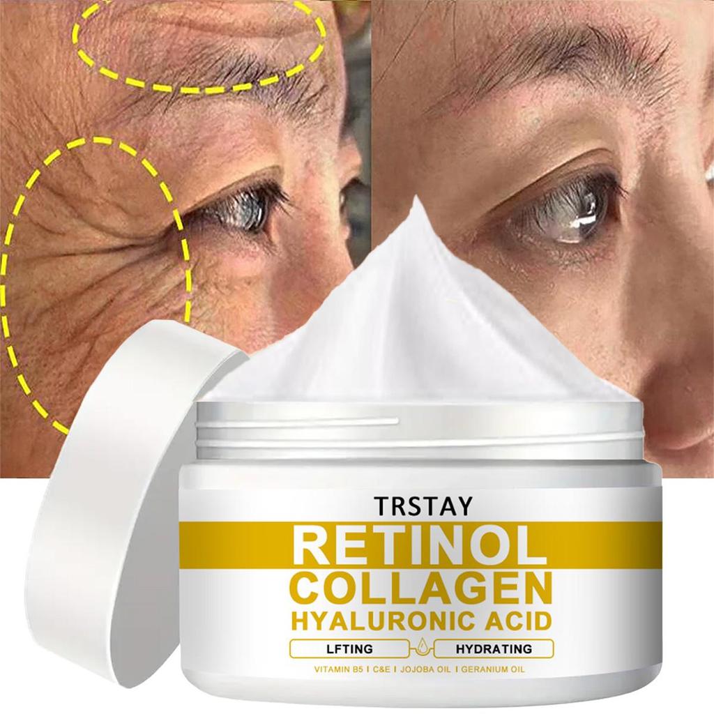 TRSTAY Антивозрастной крем для лица, коллаген, ретинол и гиалуроновая кислота, роскошный крем для кожи вокруг глаз против морщин, предотвращающий появление сухих линий