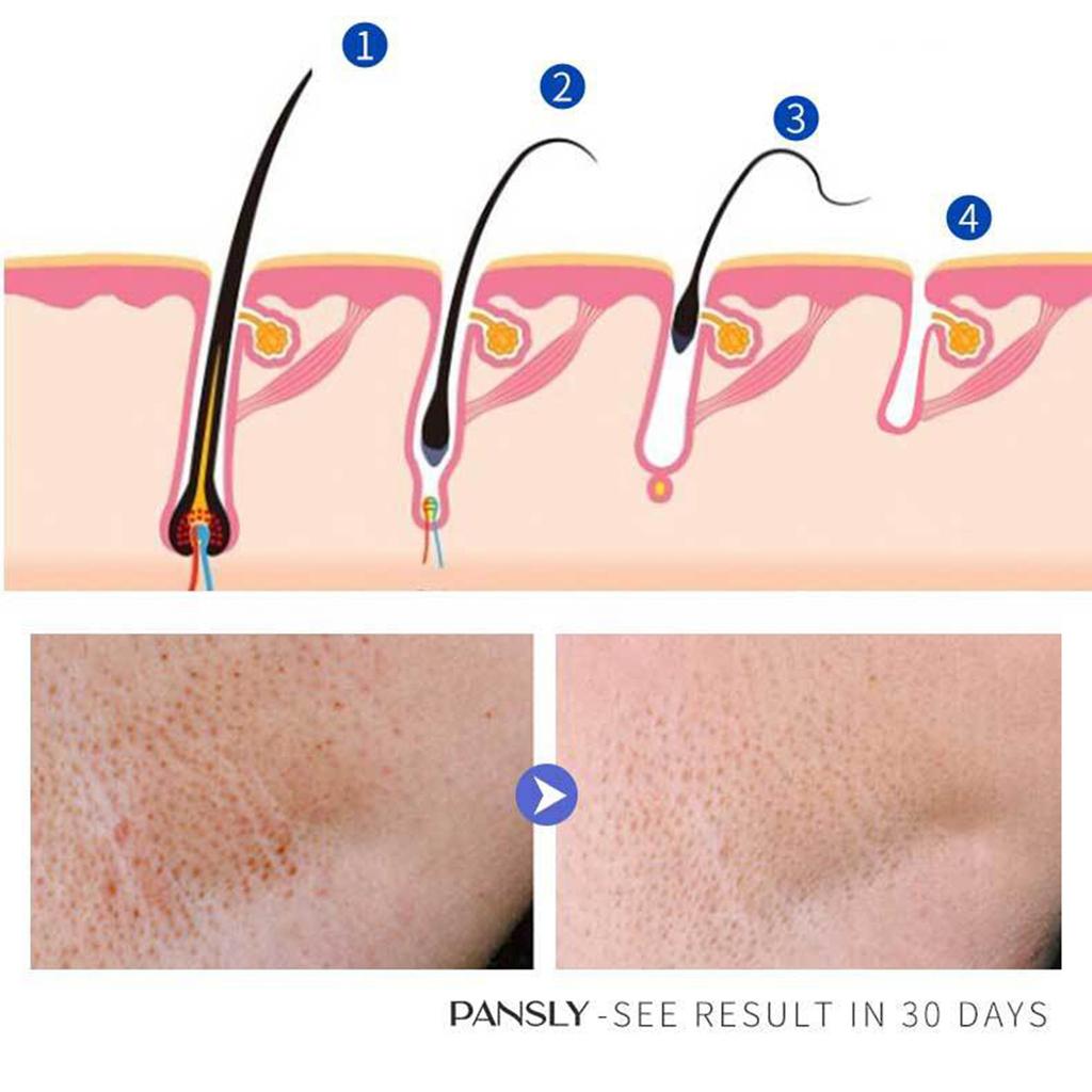 Паста для постоянного удаления волос, средство для удаления волос на лице, депилятор для бороды, подмышек, стойкое подавление роста волос на теле