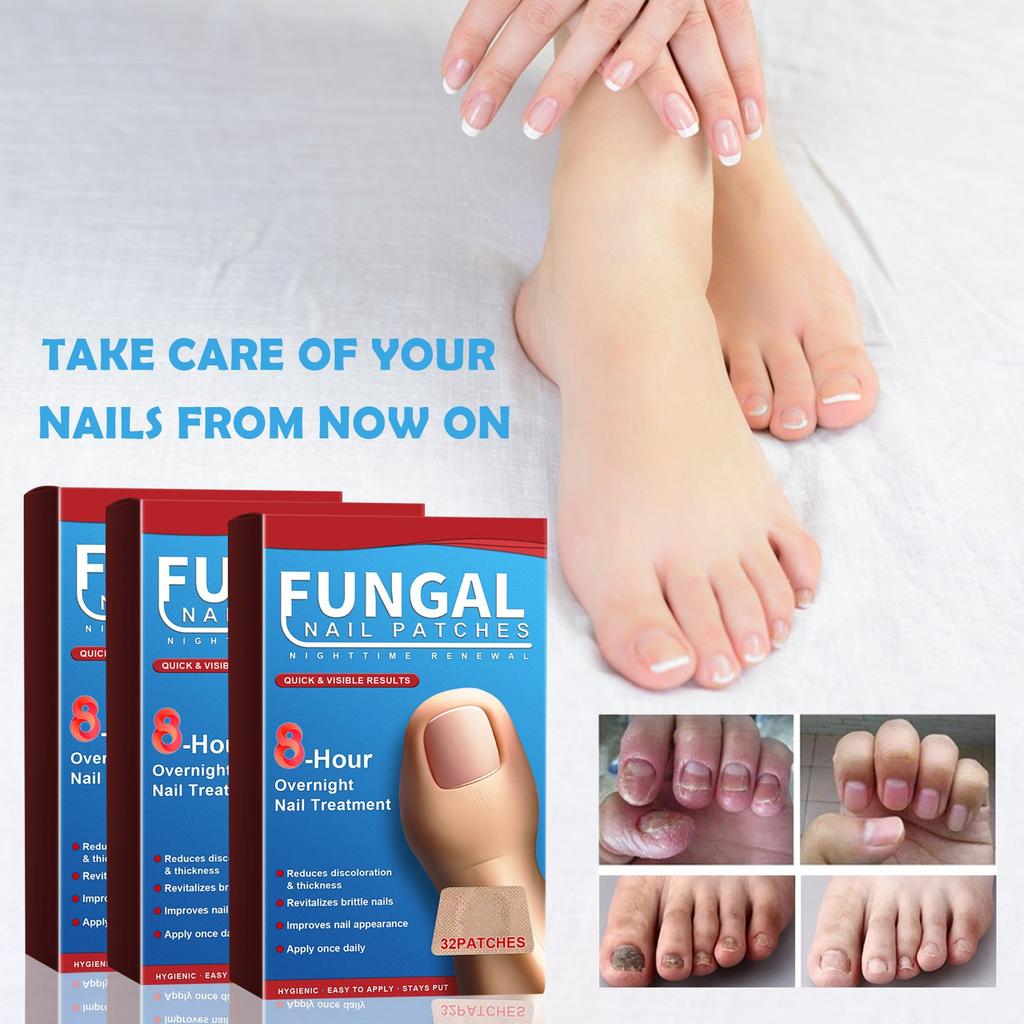 Пластыри для ухода за ночными ногтями Пластыри для ухода за ногтями Пластыри для ухода за утолщенными ногтями Вросшие ногти и мягкие ногти Пластыри для ухода за ногтями