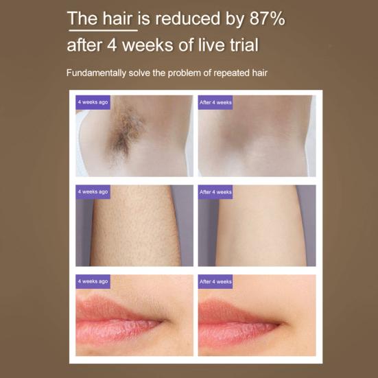 Ручной прибор для удаления волос 5 уровней регулировки Мужчины Женщины Безболезненный Постоянный Тело