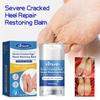 Крем для восстановления пяток Предотвращает трещины на пятках Восстанавливает сухие, потрескавшиеся, увлажненные стопы