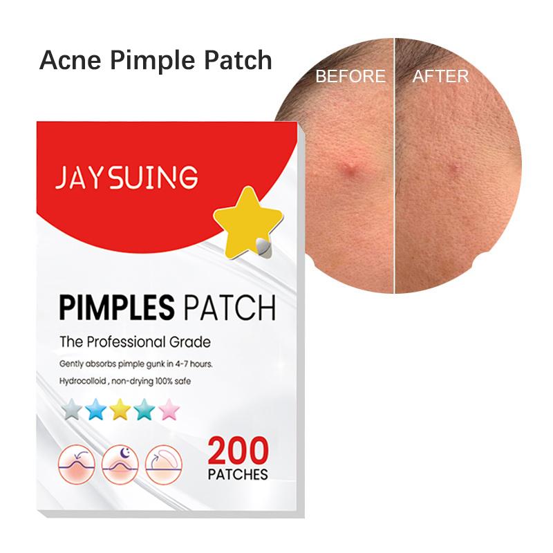200 шт. наклейка на пластырь от прыщей, водостойкий инструмент для удаления прыщей, средство для удаления пятен, маска для лица, уход за кожей, скрытые прыщи