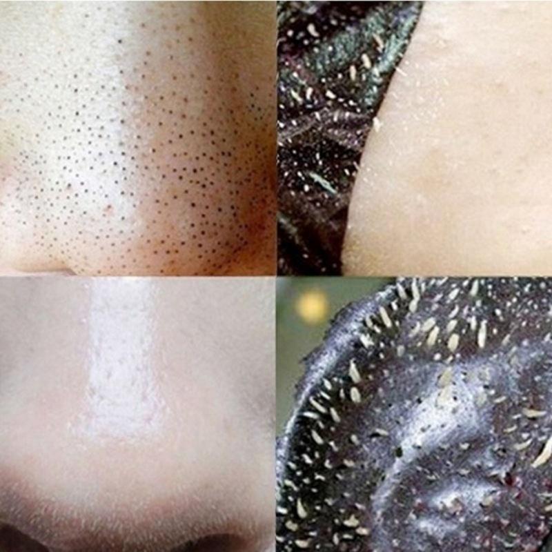 Очищающие полоски для носа против черных точек 20шт