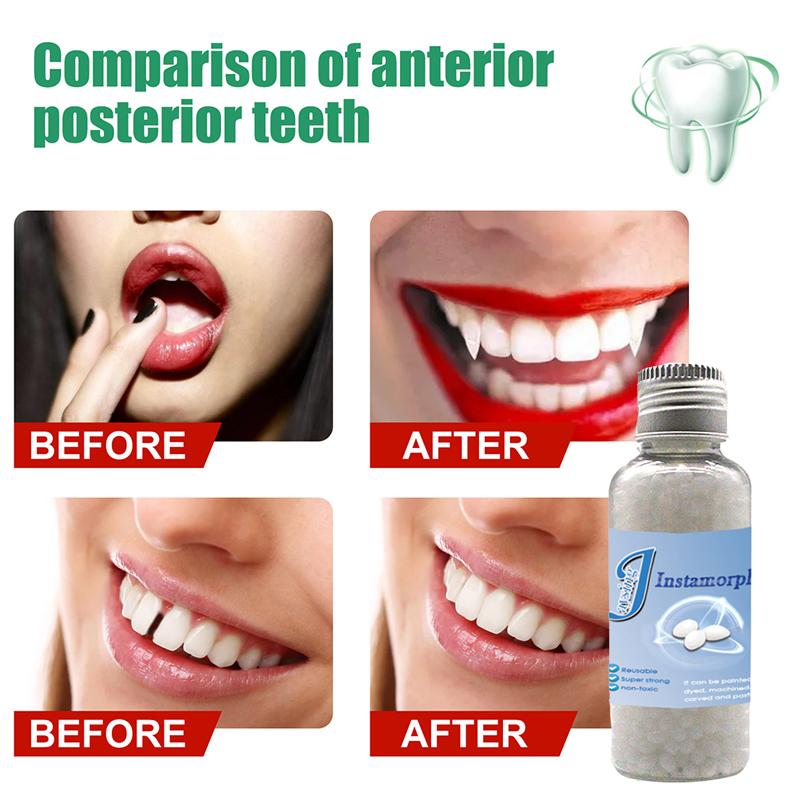 Film And Television Make-Up Dentures Modification Temporary Filling Teeth Glue False Filling Tooth Gap Filling